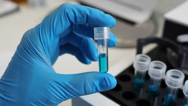 Germany says vaccine supply secure despite BioNTech production loss